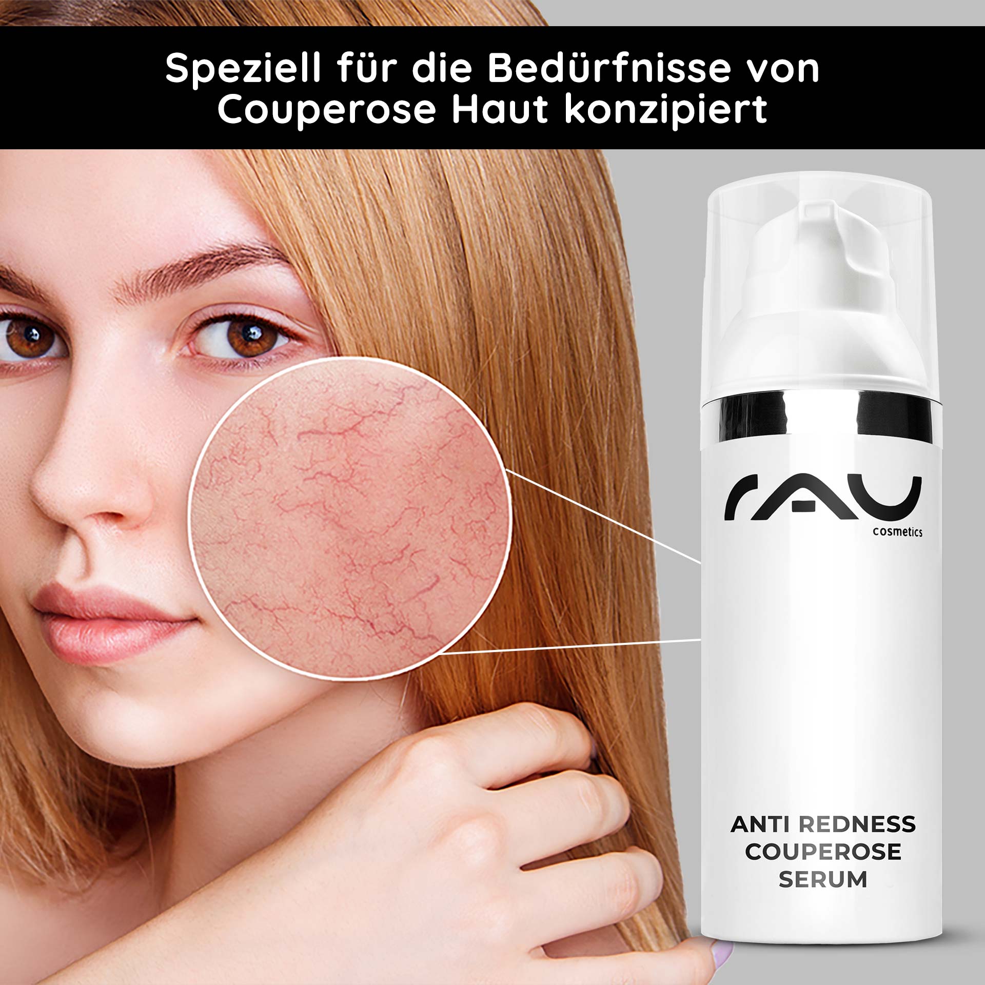 Siero antiarrossamento Couperose 50 ml per la rosacea Frau mit blonder Haar und betontem roten Hautbereich, RAU Cosmetics Anti Redness Couperose Serum im Vordergrund, speziell für Couperose-Haut entwickelt.