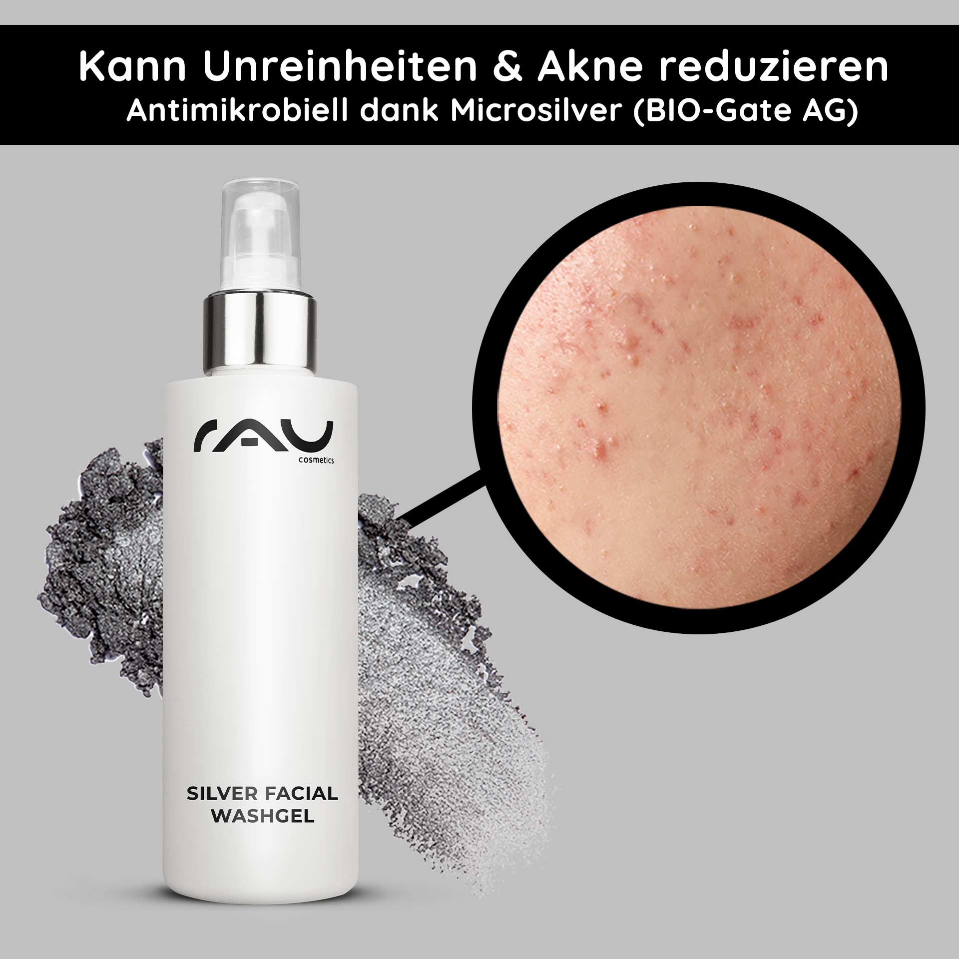 Gel per il viso all'argento 200 ml Detergente al microsilver Flasche RAU Silver Facial Washgel mit antimikrobiellem Mikrosilber, Nahaufnahme von Haut mit Akne und Unreinheiten, mit Hervorhebung der Vorteile für empfindliche und zu Akne neigende Haut.