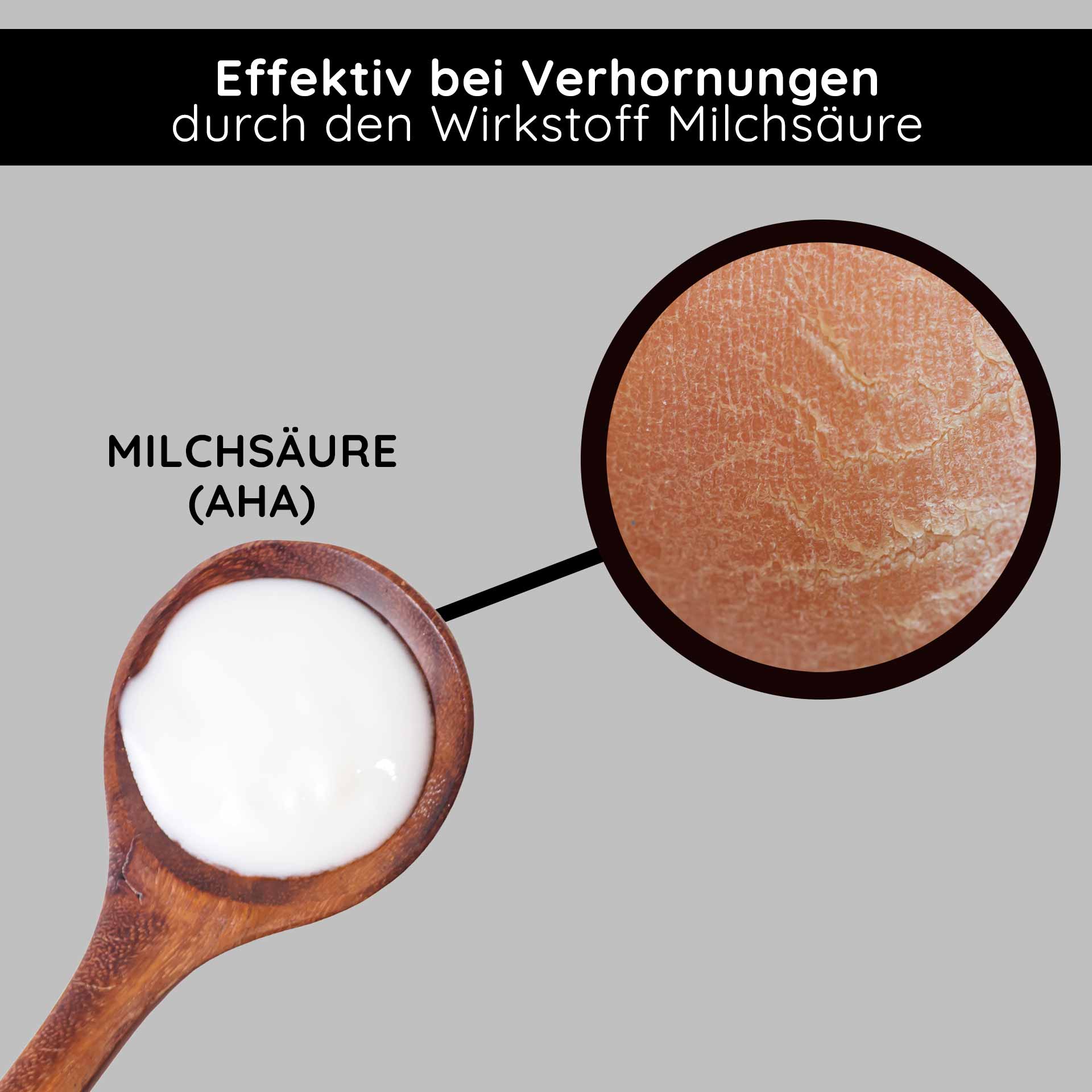 Crema agli acidi della frutta e BHA 50 ml - Crema agli acidi della frutta BHA Milchsäure (AHA) in einem Holzlöffel, wirksam gegen Verhornungen, mit Hauttextur im Detail.