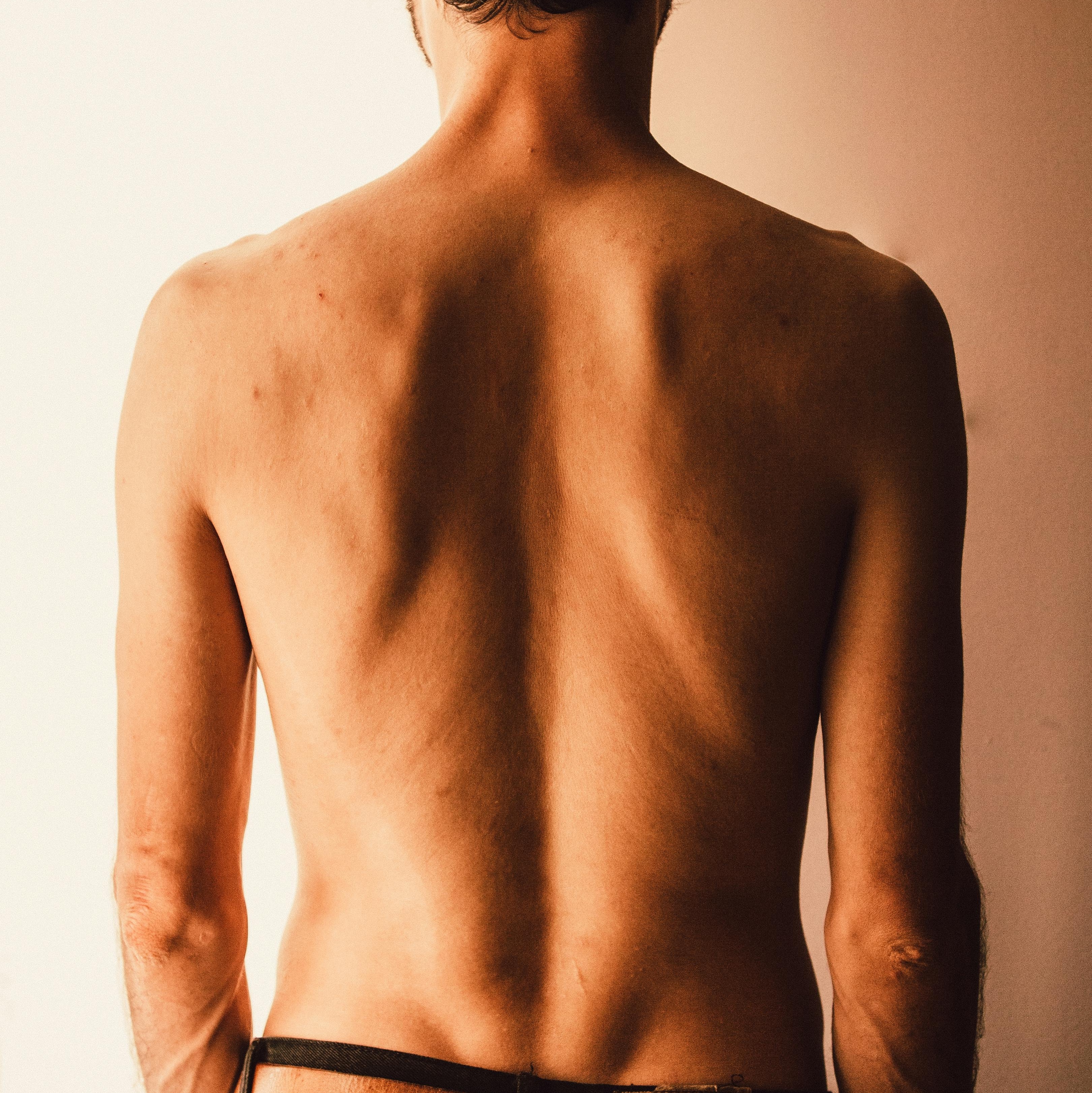 Aiuta a combattere i brufoli sulla schiena Frau mit Rückenansicht, die sich mit beiden Händen über die Schultern streckt, während sie in einem weißen Badetuch vor einem Spiegel steht.