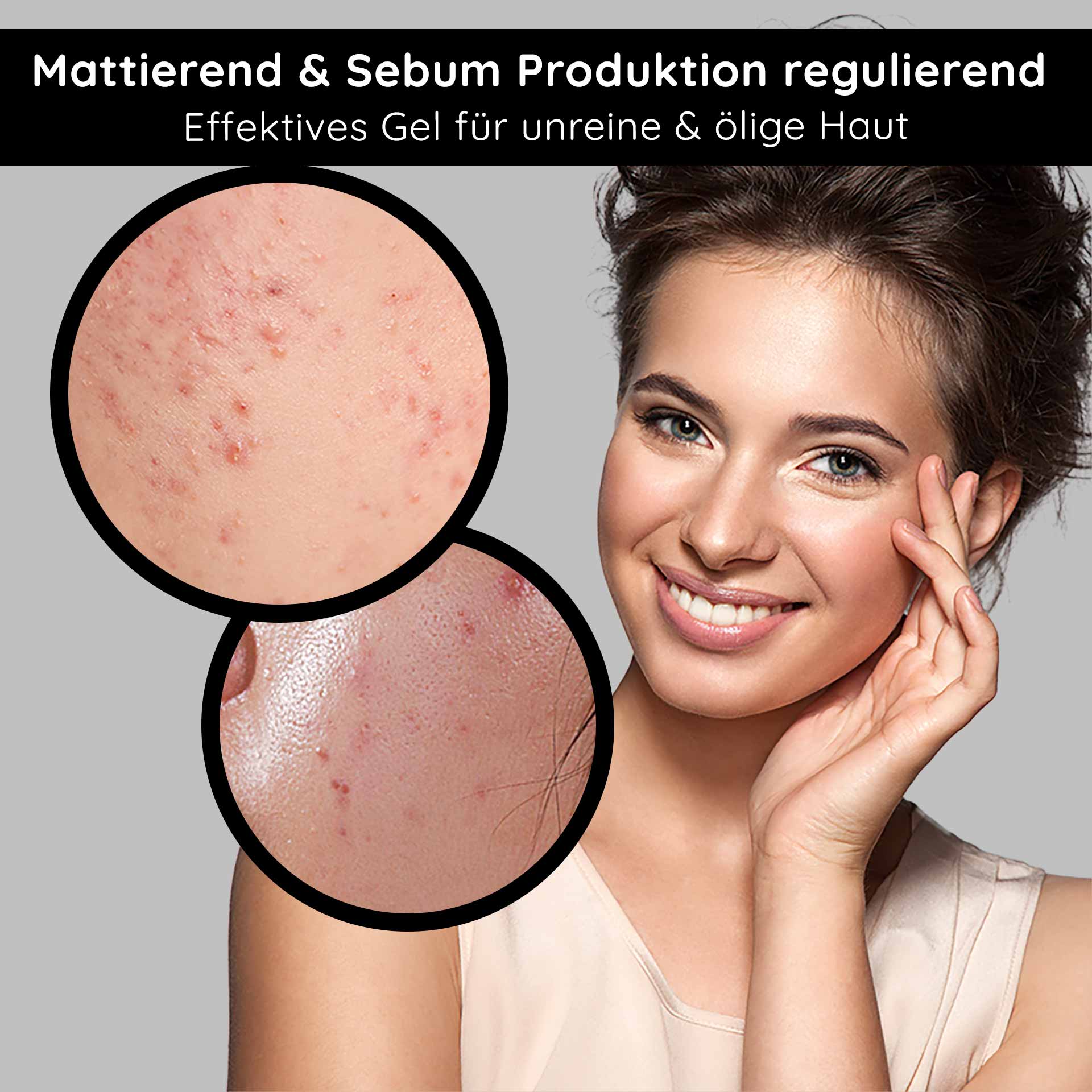 Balancing & Mattifying Gel with BHA 75 ml - trattamento viso per pelli impure e grasse con acido salicilico per la notte Mattierendes Gel für unreine und ölige Haut, Hautporen mit Unreinheiten, lächelnde Frau mit gesunder Haut, Fokus auf Hautpflege und Sebumregulation.
