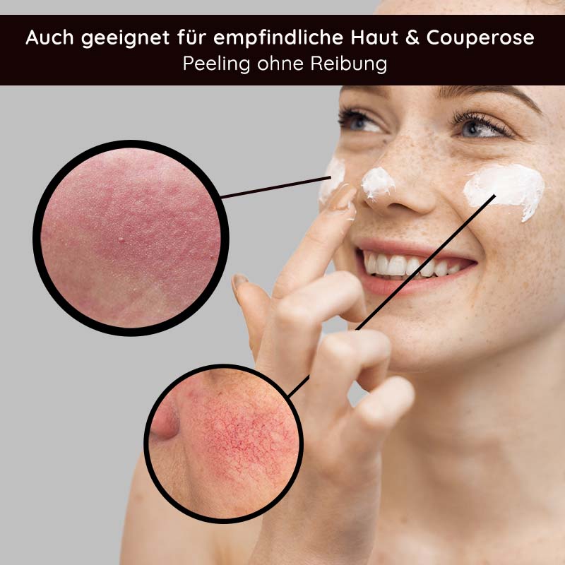 Peeling agli acidi della frutta 100 ml Peeling agli acidi della frutta con BHA