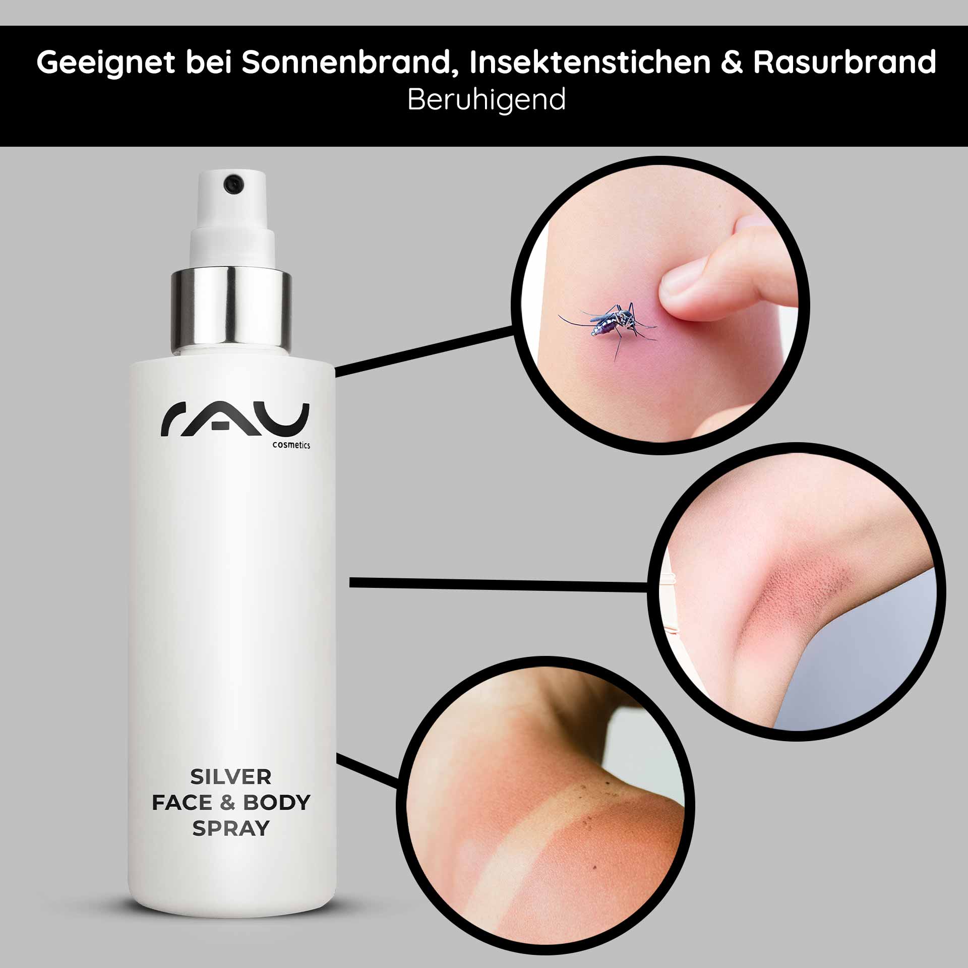 Spray viso e corpo argento 200 ml con pantenolo e microargento Silver Face & Body Spray von RAU Cosmetics, geeignet zur Linderung von Sonnenbrand, Insektenstichen und Rasurbrand, mit sichtbaren Beispielen für Hautirritationen und einem eleganten Sprühflaschendesign.