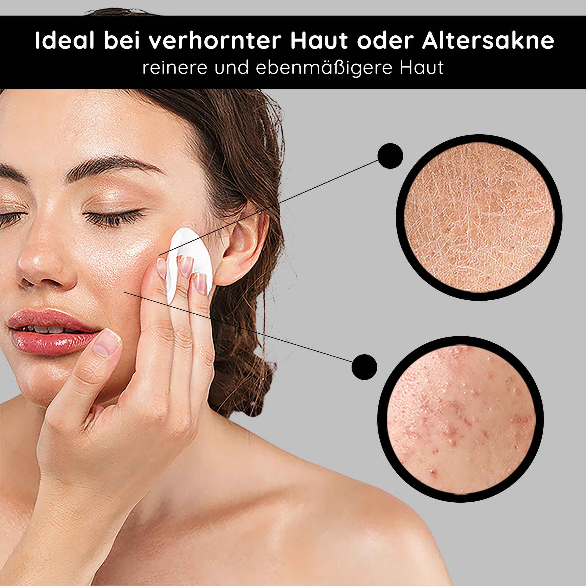 AHA Tonic 1000 ml tonico delicato agli acidi della frutta Frau mit Wattepad, das AHA Tonic auf Gesicht aufträgt, ideal bei verhornter Haut oder Altersakne, zeigt Hautunreinheiten und Texturverbesserung.