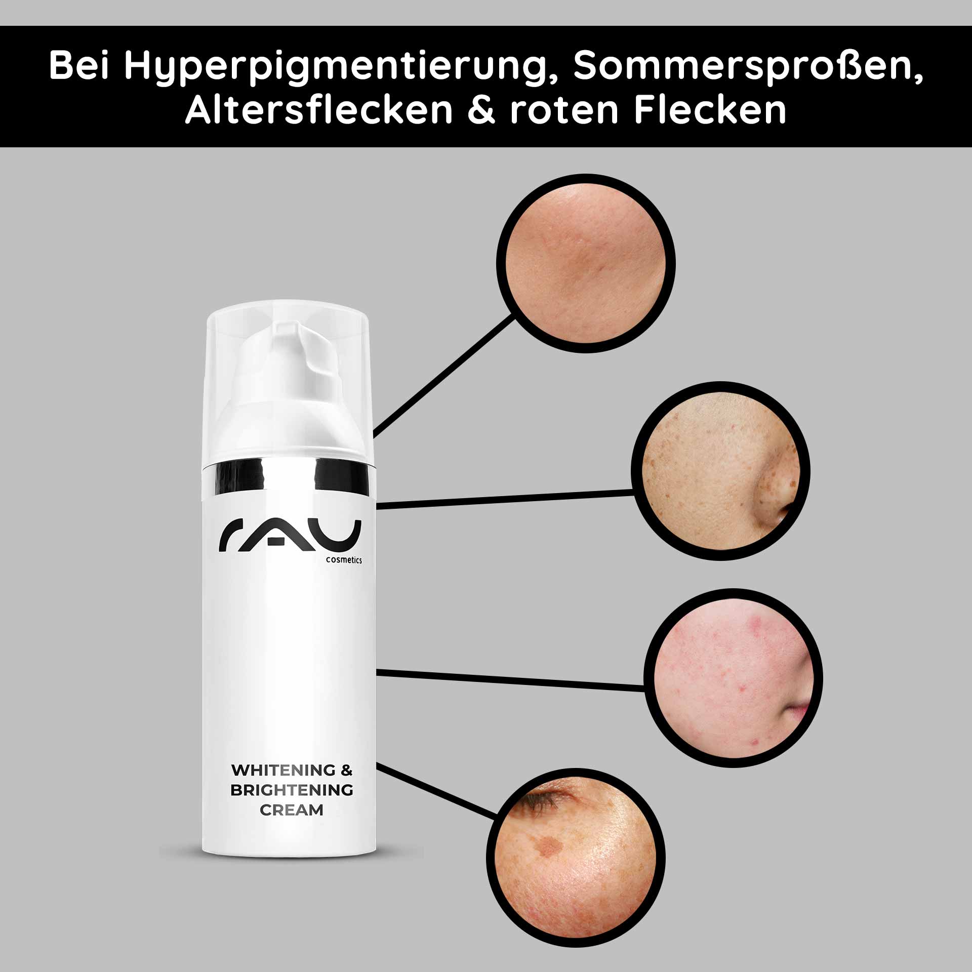 Crema sbiancante e illuminante 50 ml Illuminante per la pelle Die Whitening & Brightening Cream von RAU Cosmetics hebt Hautunreinheiten wie Hyperpigmentierung, Altersflecken und rote Flecken hervor und zeigt wirksame Lösungen zur Hautaufhellung.